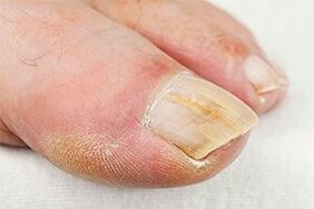 Mass -finger