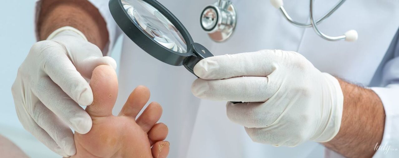 O médico examina o cogomelo no dedo do pé