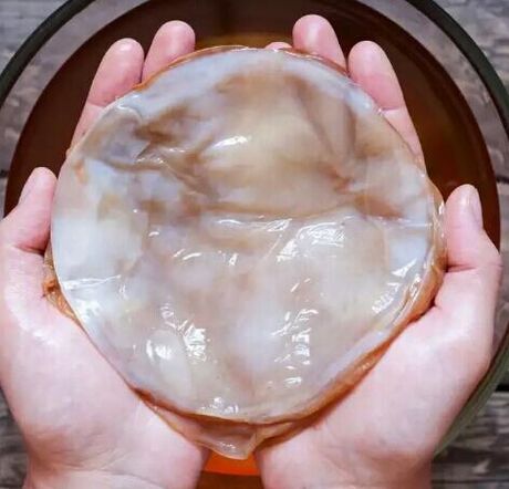 Fungo das unhas kombucha