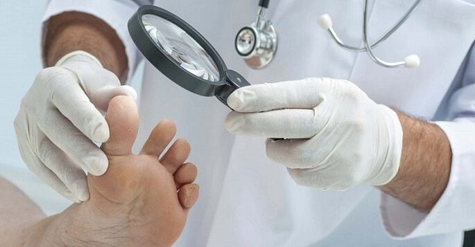 O doutor examina os pés para buscar fungos nas unhas